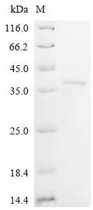 Recombinant Mouse Coiled-coil domain-containing protein 3 (Ccdc3)