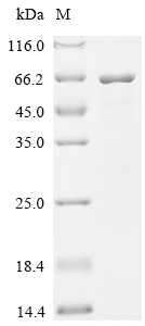 Recombinant Mycobacterium tuberculosis Glutamine synthetase (glnA1)