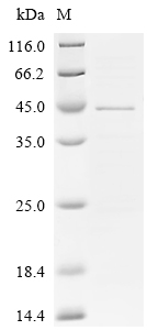 Recombinant Human UDP-GlcNAc:betaGal beta-1,3-N-acetylglucosaminyltransferase 5 (B3GNT5), partial