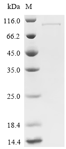 Recombinant Human Wee1-like protein kinase (WEE1)