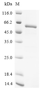Recombinant Human Cytochrome P450 11B1, mitochondrial (CYP11B1)