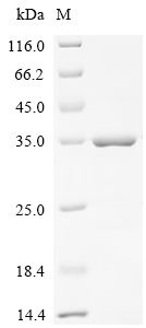 Recombinant Human C-X-C chemokine receptor type 4 (CXCR4), partial