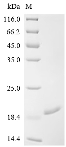 Recombinant Human YTH domain-containing family protein 1 (YTHDF1), partial