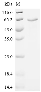 Recombinant Sendai virus Hemagglutinin-neuraminidase (HN), partial