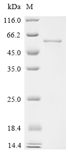 Recombinant Mouse Hydroxymethylglutaryl-CoA synthase, mitochondrial (Hmgcs2)