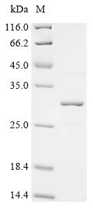 Recombinant Epstein-Barr virus Epstein-Barr nuclear antigen 1 (EBNA1), partial