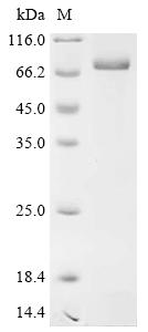 Recombinant Rat Alpha-fetoprotein (Afp)