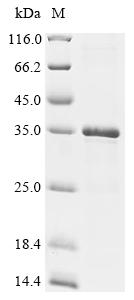 Recombinant Human Cancer/testis antigen 2 (CTAG2)