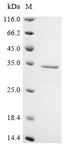 Recombinant Saccharomyces cerevisiae Ubiquitin carboxyl-terminal hydrolase YUH1 (YUH1)