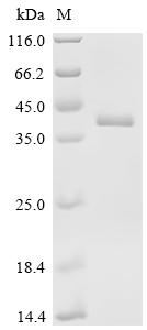 Recombinant HumanKelch-like ECH-associated protein 1 (KEAP1), partial