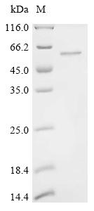 Recombinant Human Methyltransferase-like protein 17, mitochondrial (METTL17)
