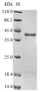 Recombinant Human Survival motor neuron protein (SMN1)