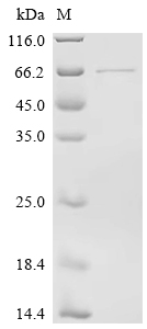 Recombinant Mouse Matrix metalloproteinase-14 (Mmp14)