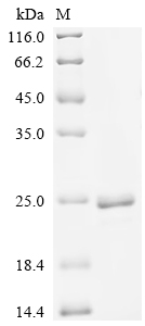 Recombinant Streptococcus agalactiae serotype V Nucleoside diphosphate kinase (ndk)
