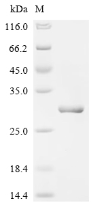 Recombinant Human Telomerase-binding protein EST1A (SMG6), partial