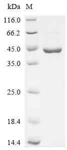 Recombinant Human Aldo-keto reductase family 1 member C3 (AKR1C3)