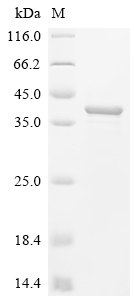 Recombinant Thermotoga maritima Pseudouridine-5'-phosphate glycosidase (psuG)