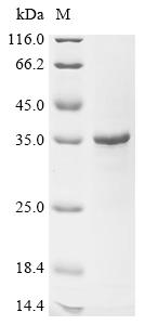 Recombinant Human Egl nine homolog 2 (EGLN2), Partial
