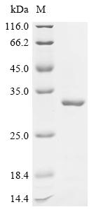 Recombinant Mouse Stathmin-2 (Stmn2)