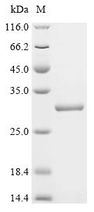 Recombinant Bovine Interleukin-6(IL6)