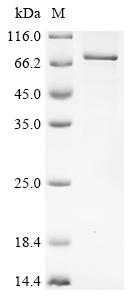 Recombinant Human Paired box protein Pax-7(PAX7)