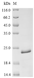 Recombinant Human herpesvirus 6A Large structural phosphoprotein (U11), partial