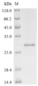 Recombinant Mouse Cyclin-dependent kinase inhibitor 1 (Cdkn1a)