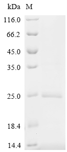 Recombinant Macaca fascicularis Hemoglobin subunit beta (HBB)