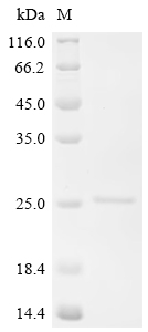 Recombinant Macaca fascicularis Hemoglobin subunit alpha-A/Q/R/T