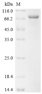 Recombinant Human Glucose 1,6-bisphosphate synthase (PGM2L1)