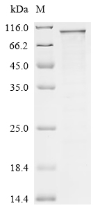 Recombinant Human Segment polarity protein dishevelled homolog DVL-3 (DVL3)