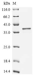 Recombinant Human Serine/threonine-protein phosphatase PGAM5,mitochondrial (PGAM5), partial