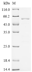 Recombinant Human Serine/threonine-protein phosphatase PGAM5,mitochondrial (PGAM5), partial