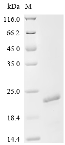 Recombinant Mouse Gamma-synuclein (Sncg)