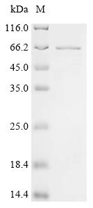 Recombinant Human N6-adenosine-methyltransferase non-catalytic subunit (METTL14)