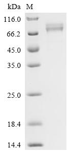 Recombinant Human Desmoglein-1 (DSG1), partial
