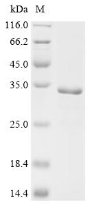 Recombinant Mouse Peroxisomal coenzyme A diphosphatase NUDT7 (Nudt7)
