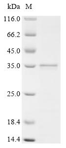 Recombinant Human Suppression of tumorigenicity 18 protein (ST18), partial