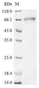 Recombinant Human Elastin (ELN)