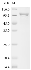 Recombinant Human 4-aminobutyrate aminotransferase, mitochondrial (ABAT)