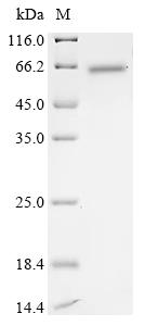 Recombinant Human Transcription intermediary factor 1-beta (TRIM28), partial