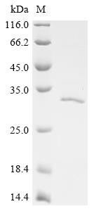 Recombinant Human Tyrosine-protein phosphatase non-receptor type 14 (PTPN14), partial