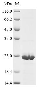 Recombinant Mouse Gamma-synuclein (Sncg)