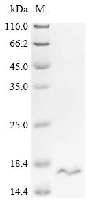 Recombinant Mouse Solute carrier family 22 member 17 (Slc22a17), partial