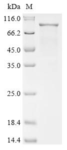 Recombinant Human Segment polarity protein dishevelled homolog DVL-1 (DVL1)