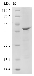 Recombinant Human Filaggrin (FLG), partial