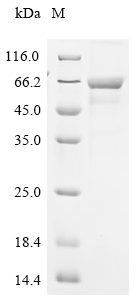 Recombinant Mouse Tyrosine-protein kinase Srms (Srms)