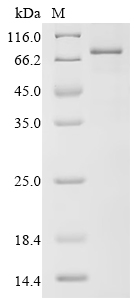Recombinant Human Complement factor I (CFI)