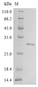 Recombinant Human Collagen alpha-1(XI) chain (COL11A1), partial