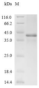Recombinant Mouse Dickkopf-related protein 4 (Dkk4)